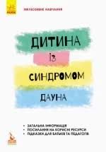 Дитина із синдромом Дауна